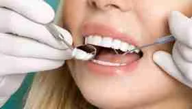 Dental Implant Procedure