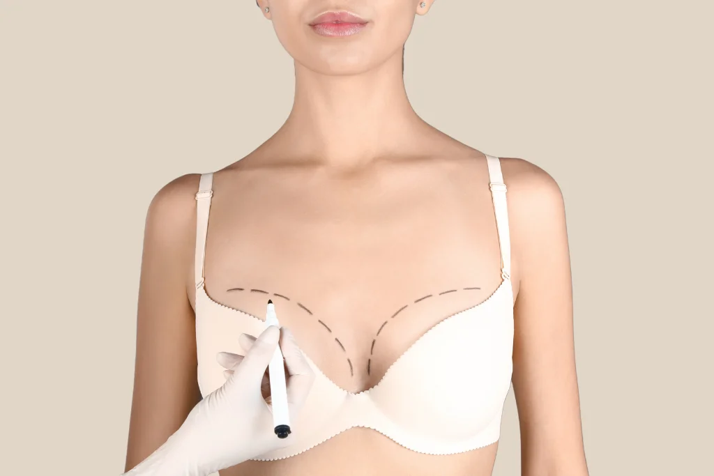 Breast Surgery