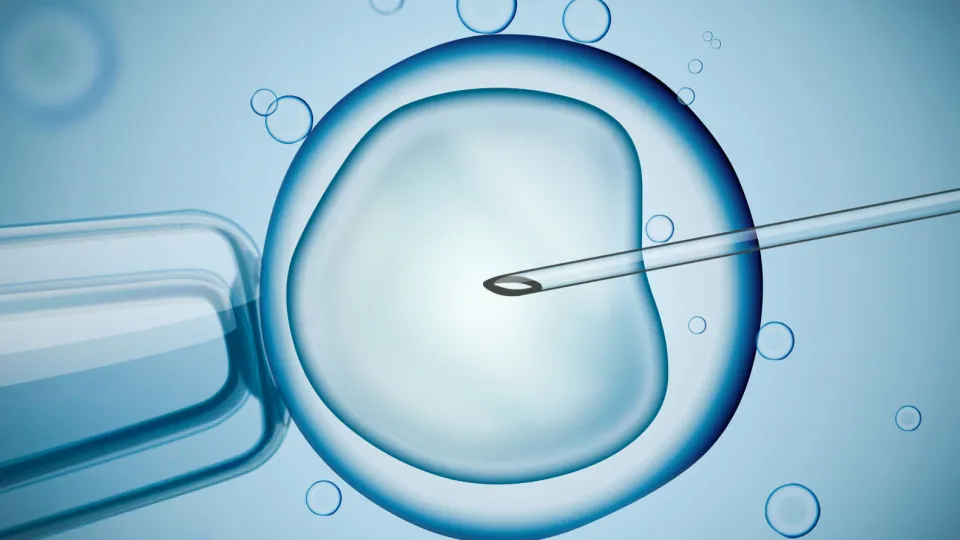 Artificial Insemination IVF in Istanbul