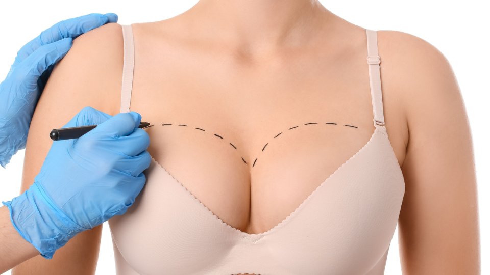 Breast Aesthetic Surgery in Turkey 2
