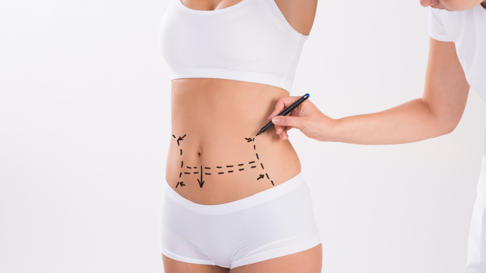 Extended Tummy Tuck Near Me Istanbul Turkey