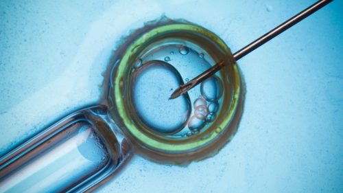 IVF - in vitro infertilisation Istanbul Turkey Cyprus