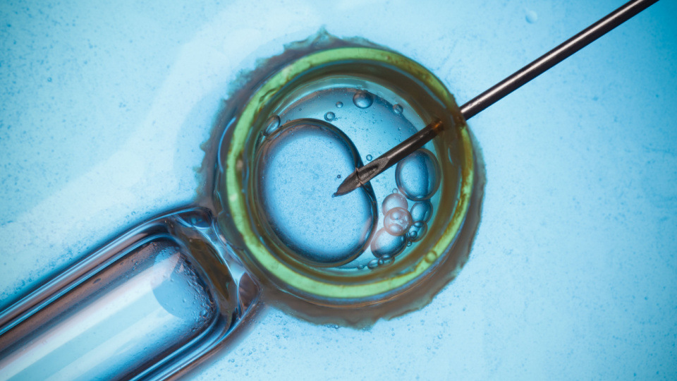 IVF In-vitro-Fertilisation Istanbul Türkei