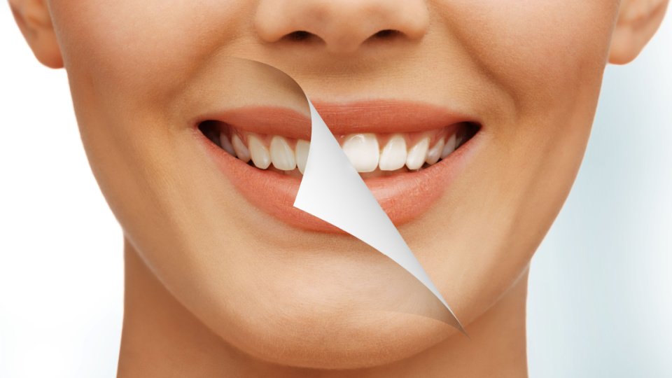 Отбеливание зубов для чувствительных зубов