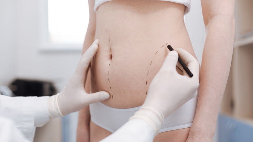 Yakınımdaki Tümesan Liposuction Türkiye