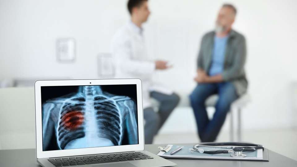 Lung Cancer Treatment in Istanbul Turkey