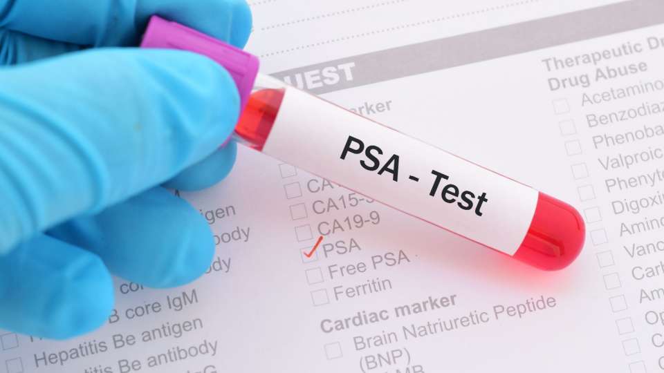 Türkiye'de İstanbul'da Prostat Kanseri Tedavisi için PSA Testi