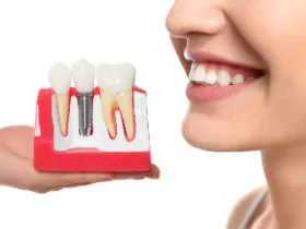 dental implant in istanbul turkey