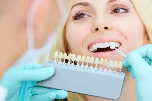 Full mouth restoration in Istanbul Turkey