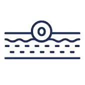 Lipoaspiration technique