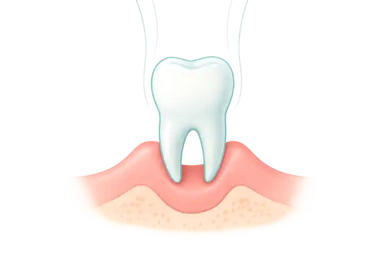 Root Canal or Extraction in Istanbul Turkey compare