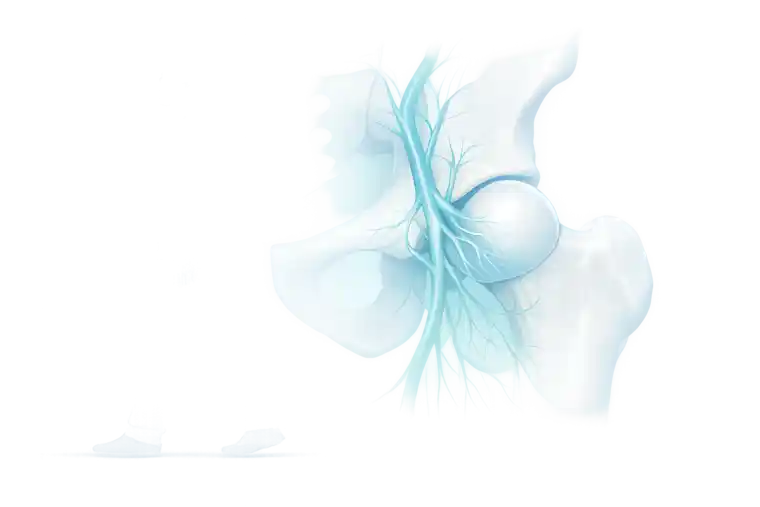 نخر رأس الفخذ غير الوعائي - العلاج بالخلايا الجذعية في اسطنبول في تركيا