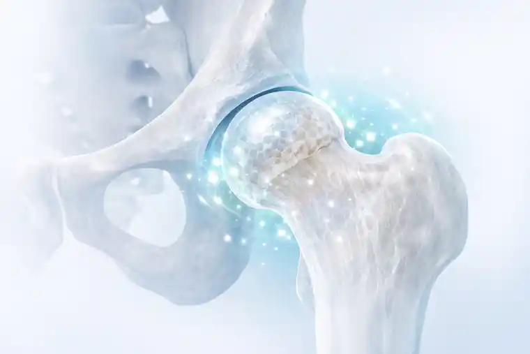 Stem Cell Therapy for Femoral Head Avascular Necrosis Istanbul Turkey