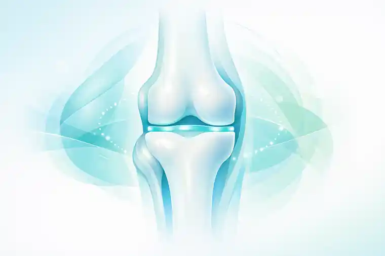 кандидат на регенеративное лечение остеоартроза коленного сустава.