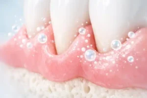 Exosome therapy for periodontitis and gum tissue regeneration