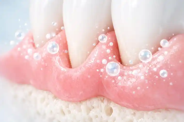 Exosome therapy for periodontitis and gum tissue regeneration