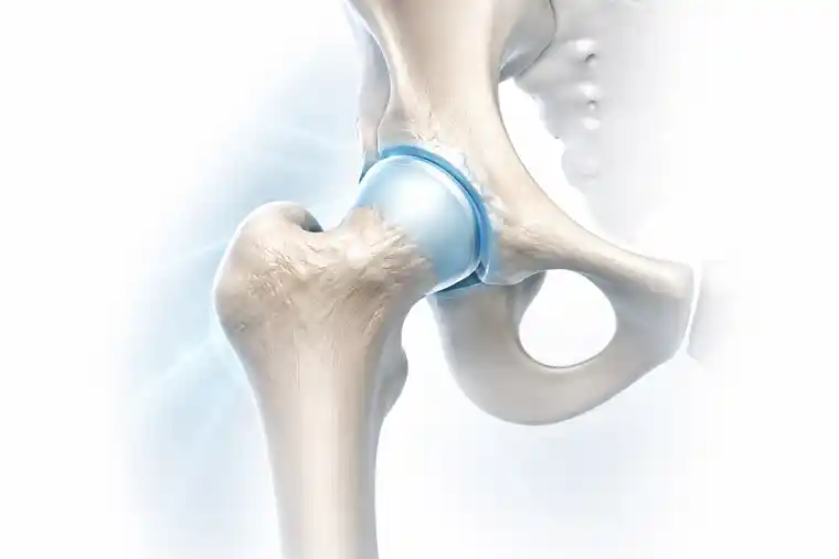 Hip joint worth preserving for stem cell treatment shown in a clear medical illustration