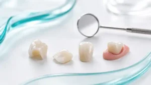 Broken dental crown, cracked veneer, and dental restoration pieces on a clean clinical surface