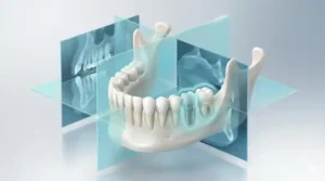 cbct-scan-before-dental-implants- - 3D CBCT scan visualization showing jawbone, teeth and dental implant planning with layered imaging panels