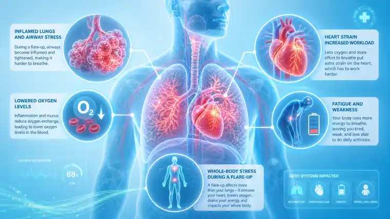 COPD flare-ups illustration showing effects on the lungs, heart, oxygen levels and whole body in a medical style